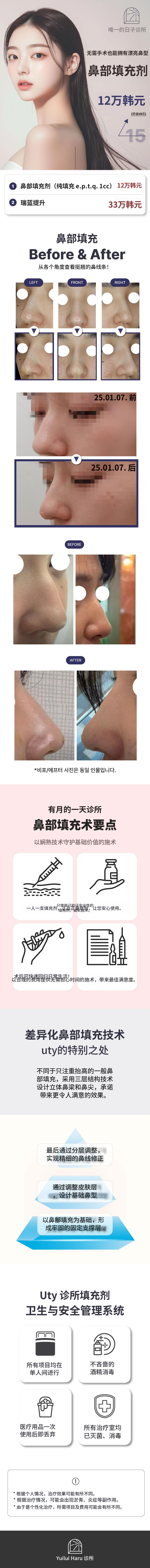 六月的一天定制鼻填充剂