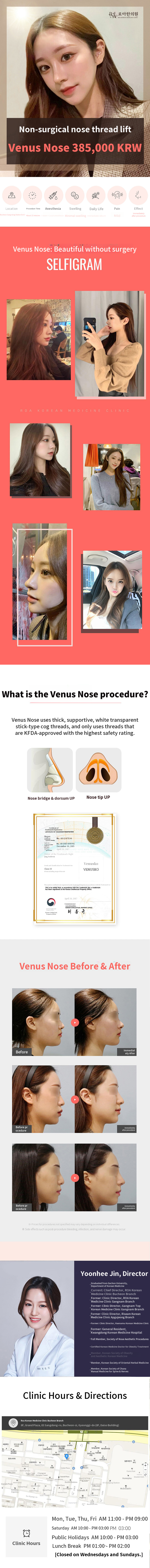 Venus Nose Using Threads, Highly Rated Clinic
