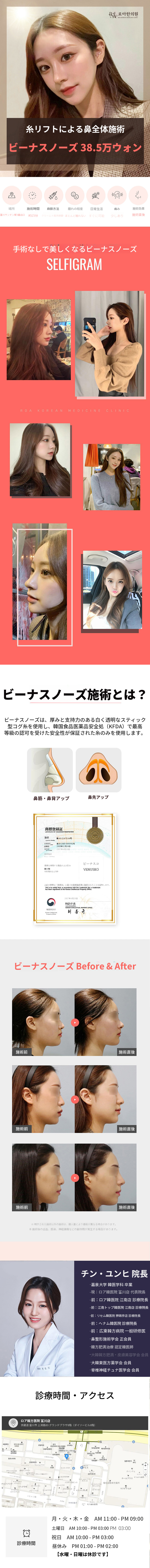 埋没糸を使用したビーナス鼻、評判の良いところ