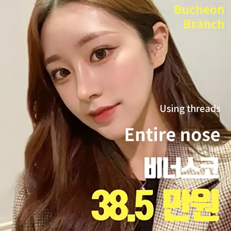 Venus Nose Using Threads, Highly Rated Clinic