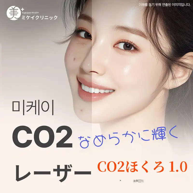 ミケイ CO2レーザー_ほくろ、いぼ