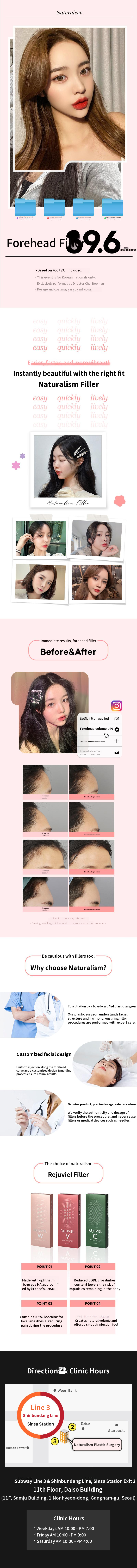 Natural Style Forehead Filler