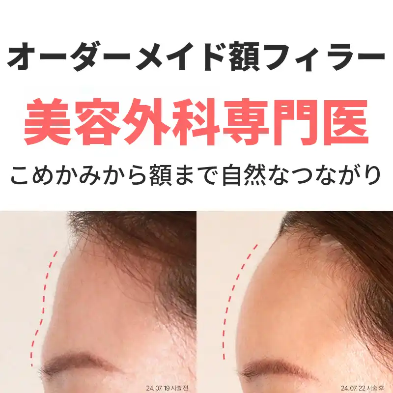 カスタム額フィラー4cc