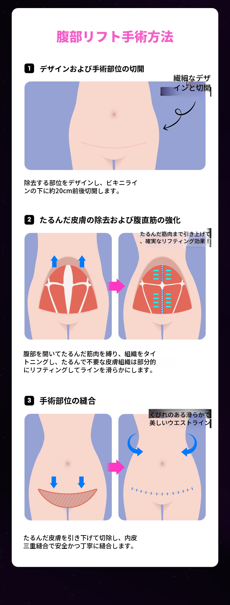 ❤ビュ❤腹部リフト術
