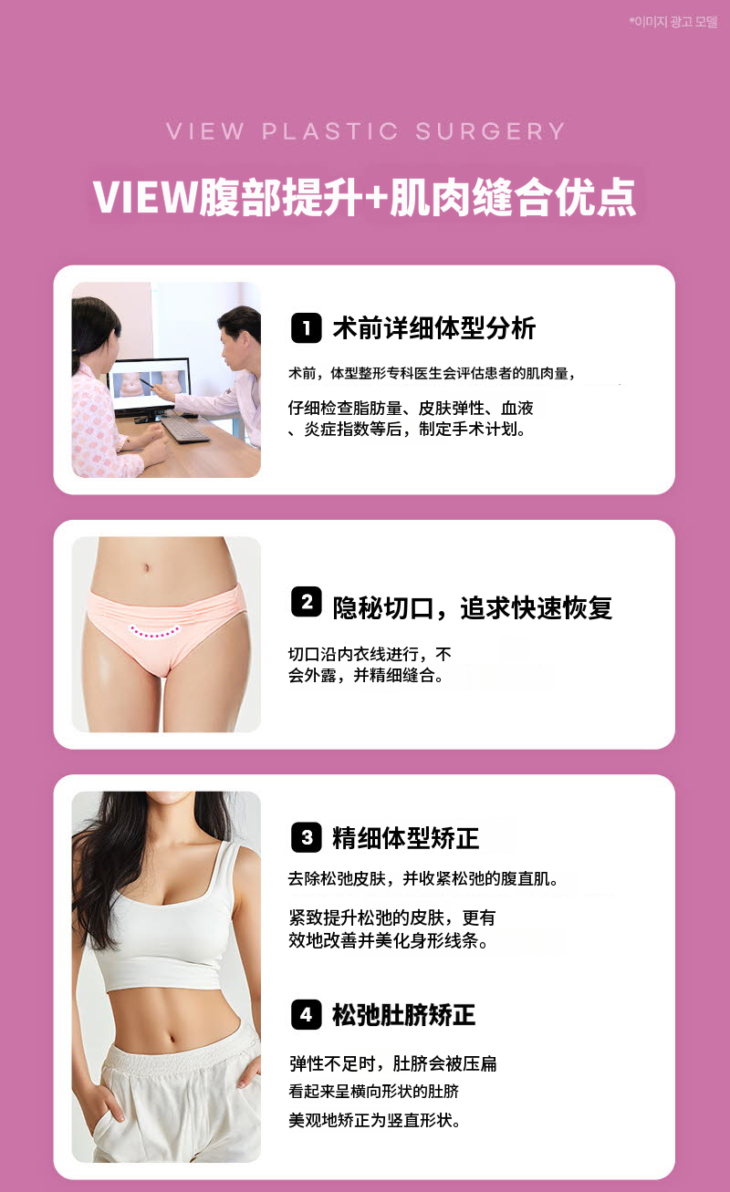 ❤美丽❤腹部提升术