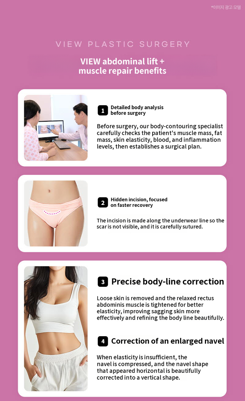 ❤View❤Abdominoplasty