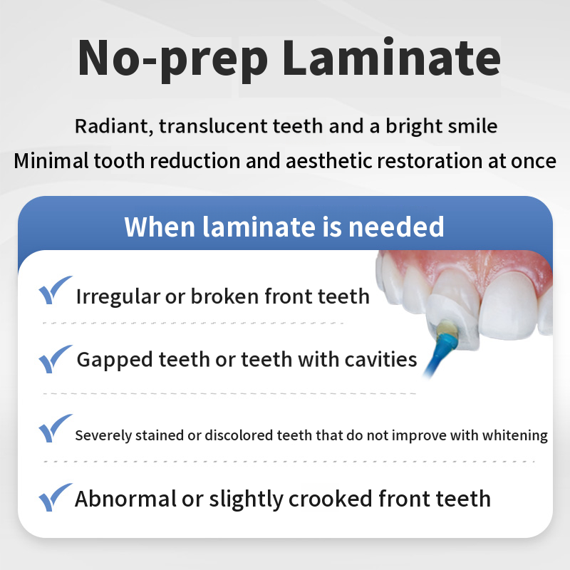 Non-invasive laminate without tooth damage