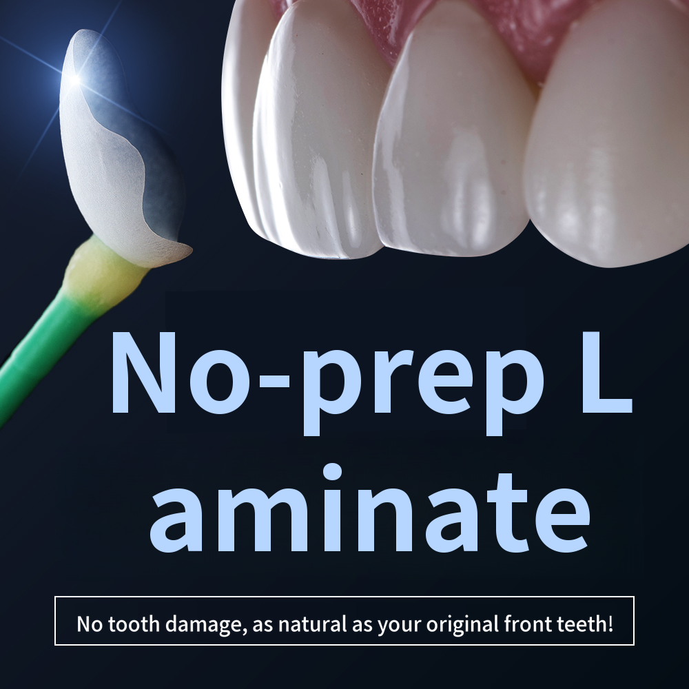 Non-invasive laminate without tooth damage