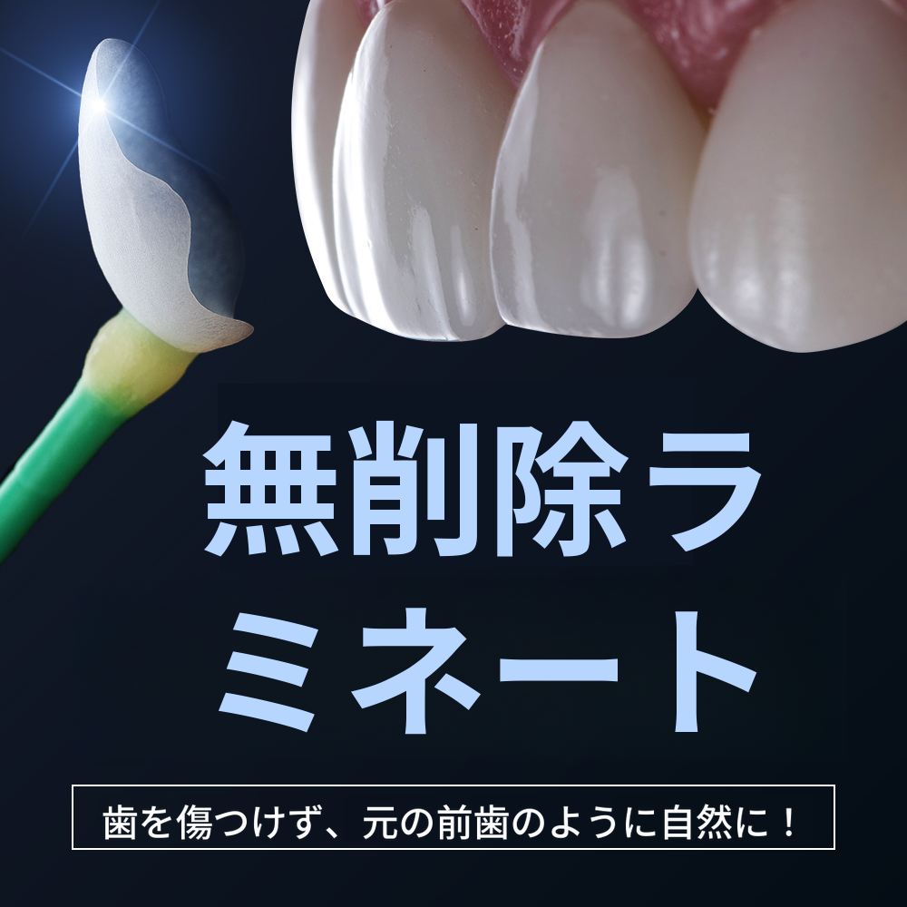 歯の損傷なし 無削除ラミネート