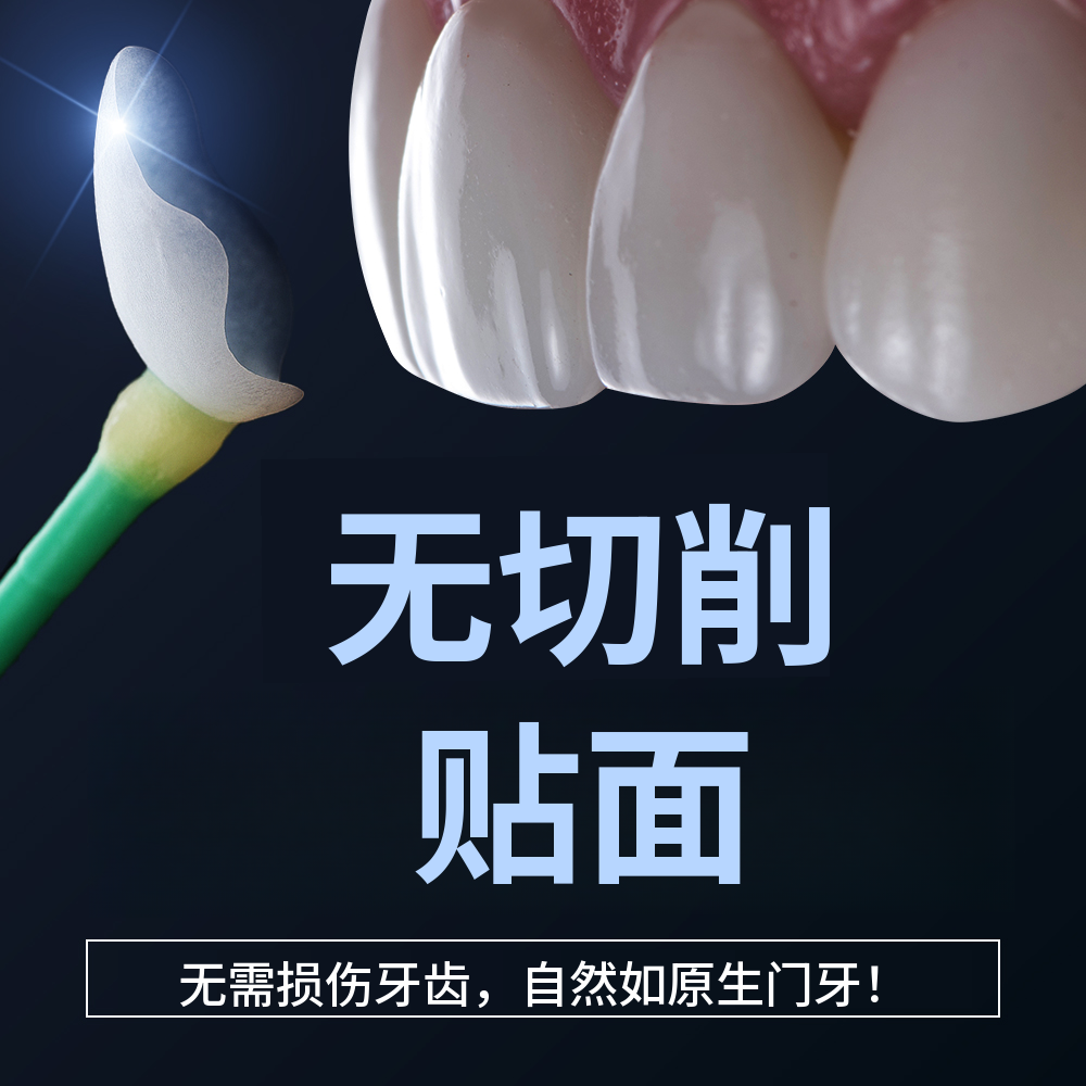 没有牙齿损伤的无删除瓷贴面