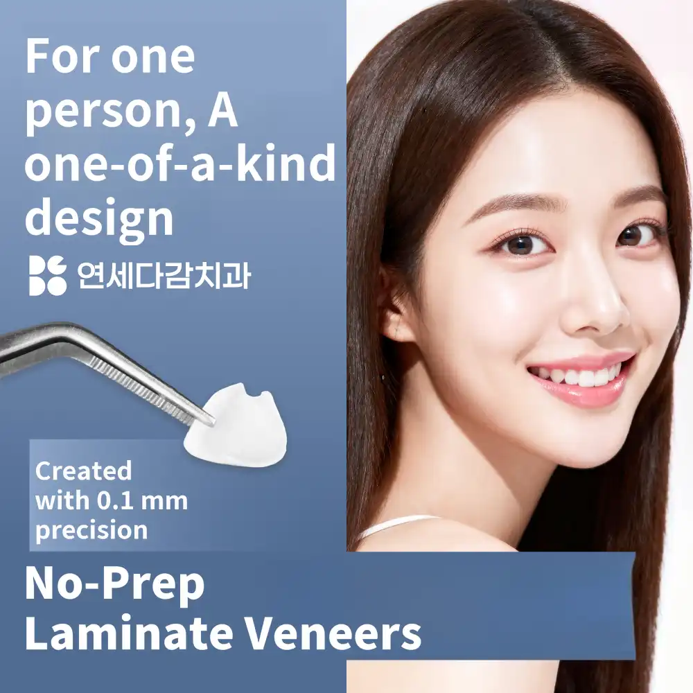 Non-Prep Dental Veneers with No Tooth Damage