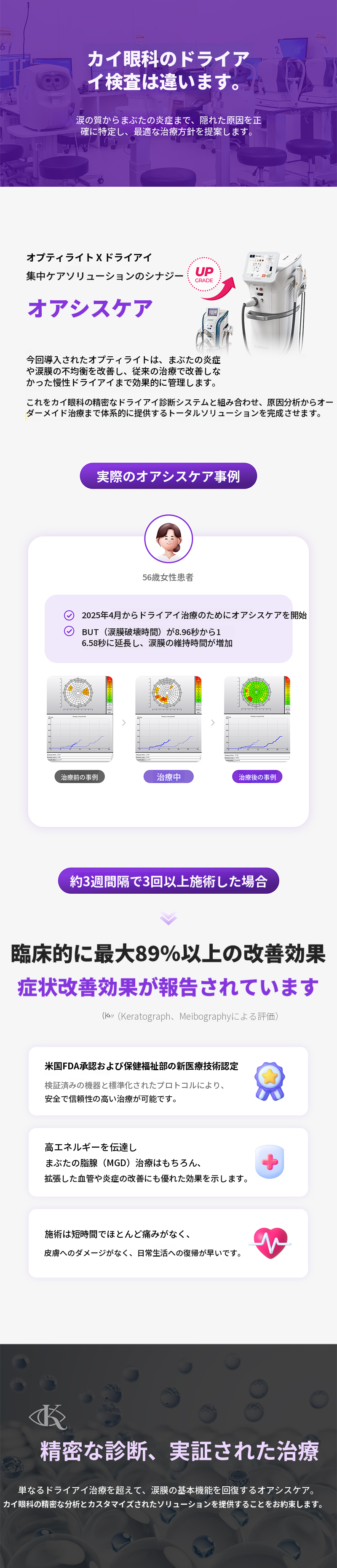 ドライアイ治療 割引イベント
