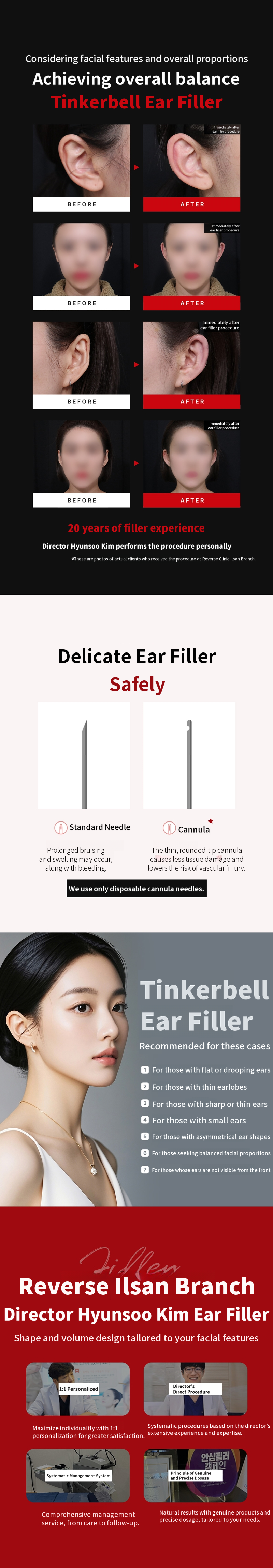 Ilsan - Ear Filler Specialist Treatment