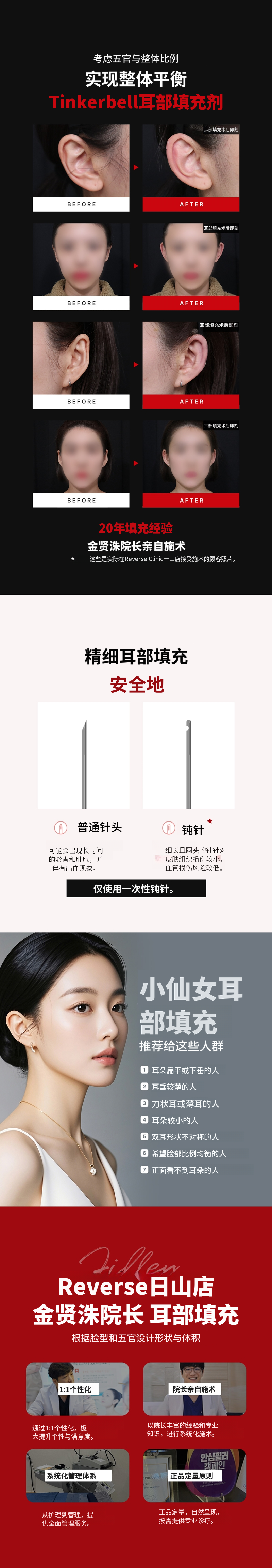 日山 - 耳填充物代表医生单独治疗