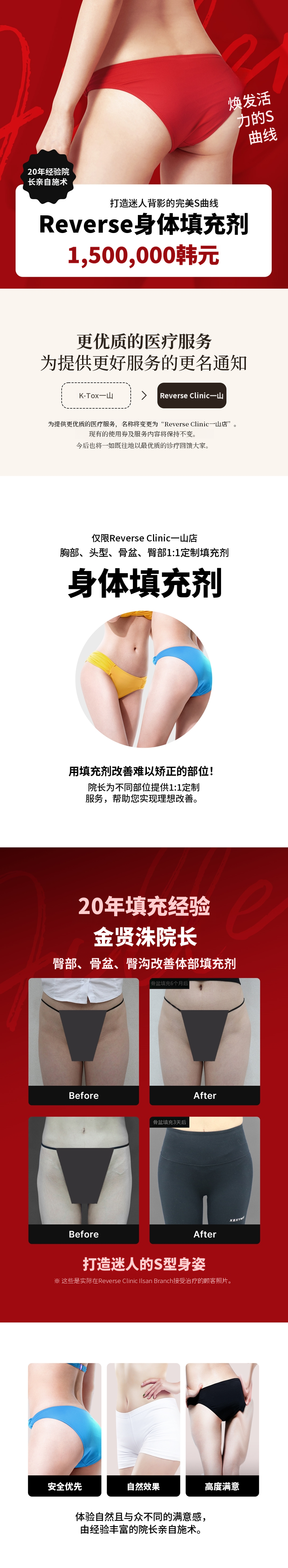 日山 - 身体填充剂，院长单独操作