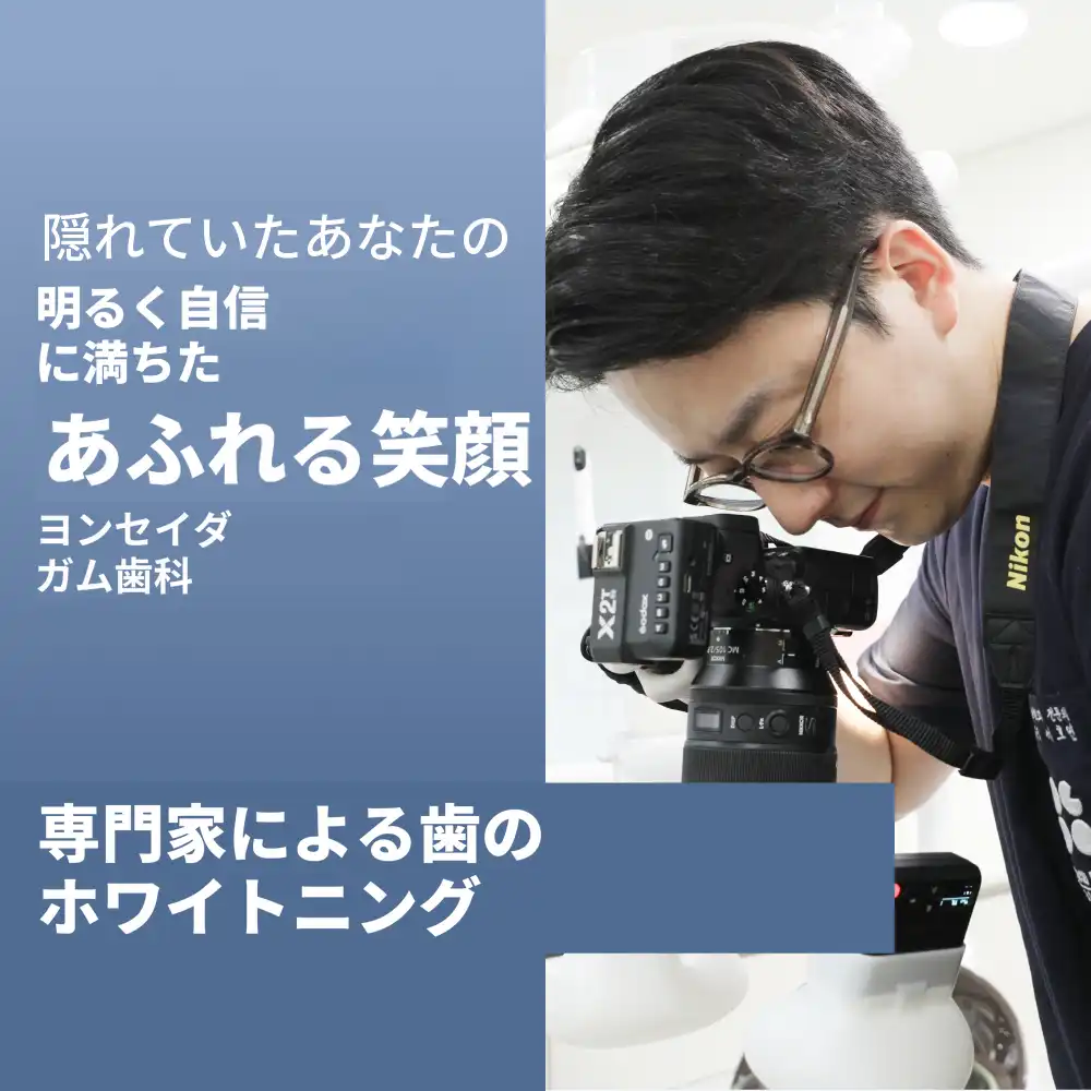 もう一度白く、歯のホワイトニング／当日2回
