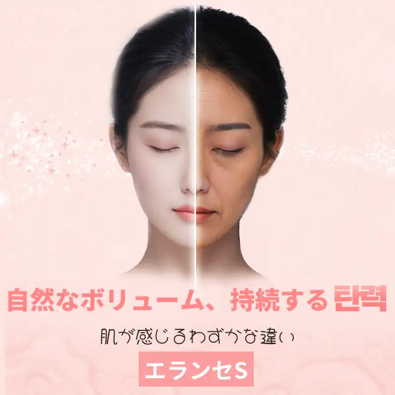 シャインユ_エランセS 1CC