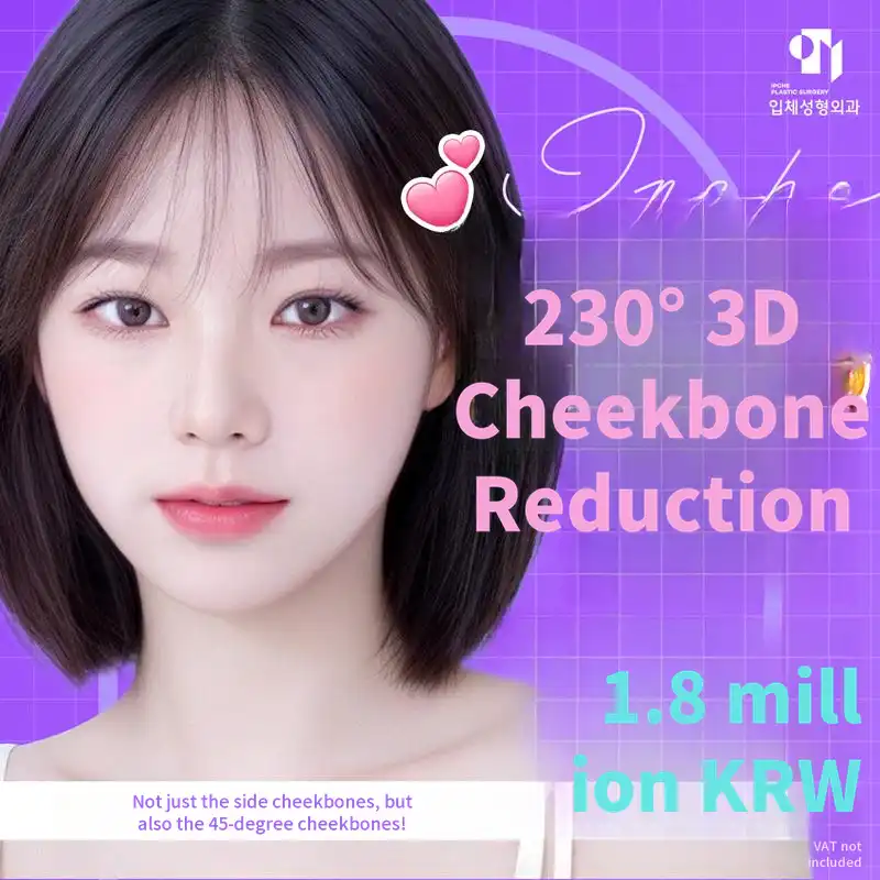 230-Degree 3D Zygoma Reduction
