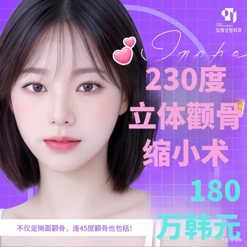 230度立体颧骨缩小手术