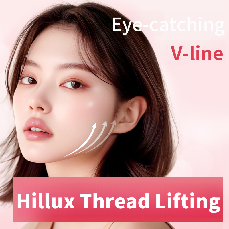 Shine You_Hilux Thread
