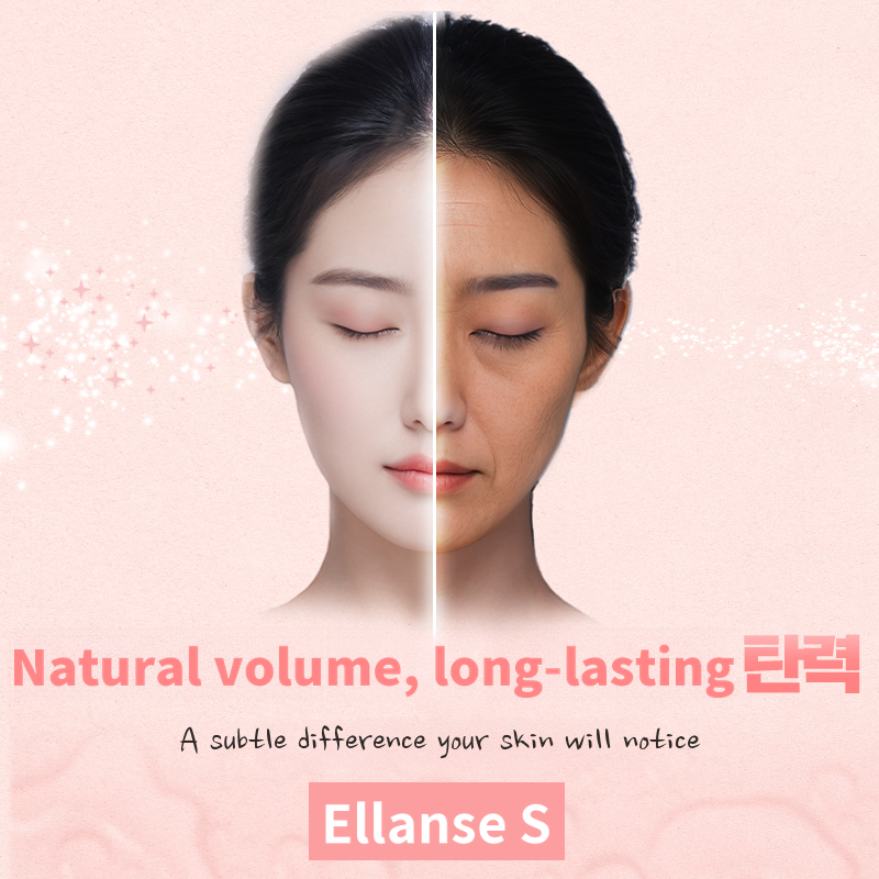 Shine You_Elance S 3+1CC