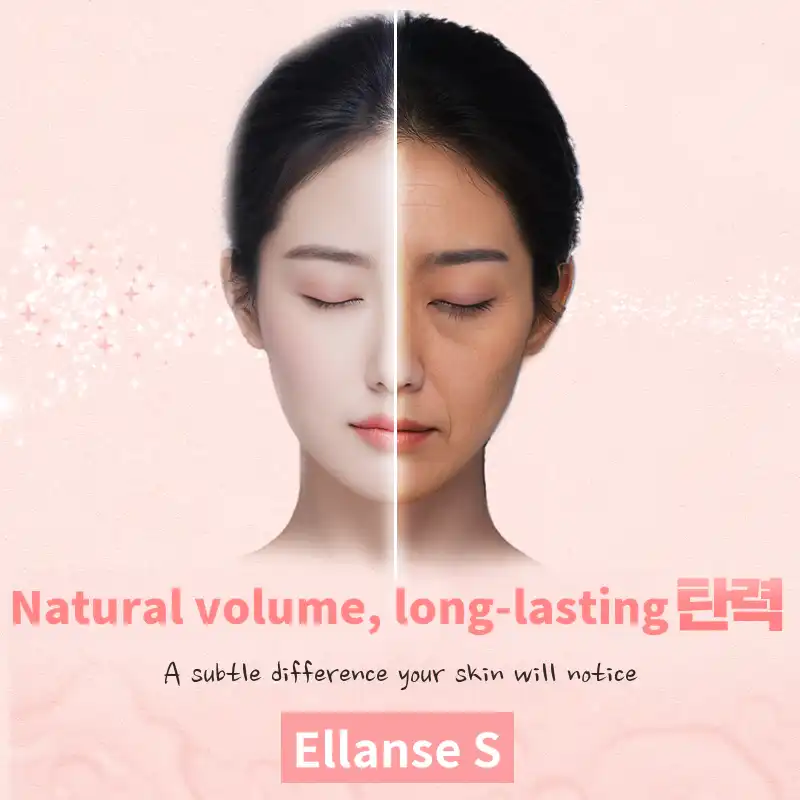 Shine You_Elance S 3+1CC