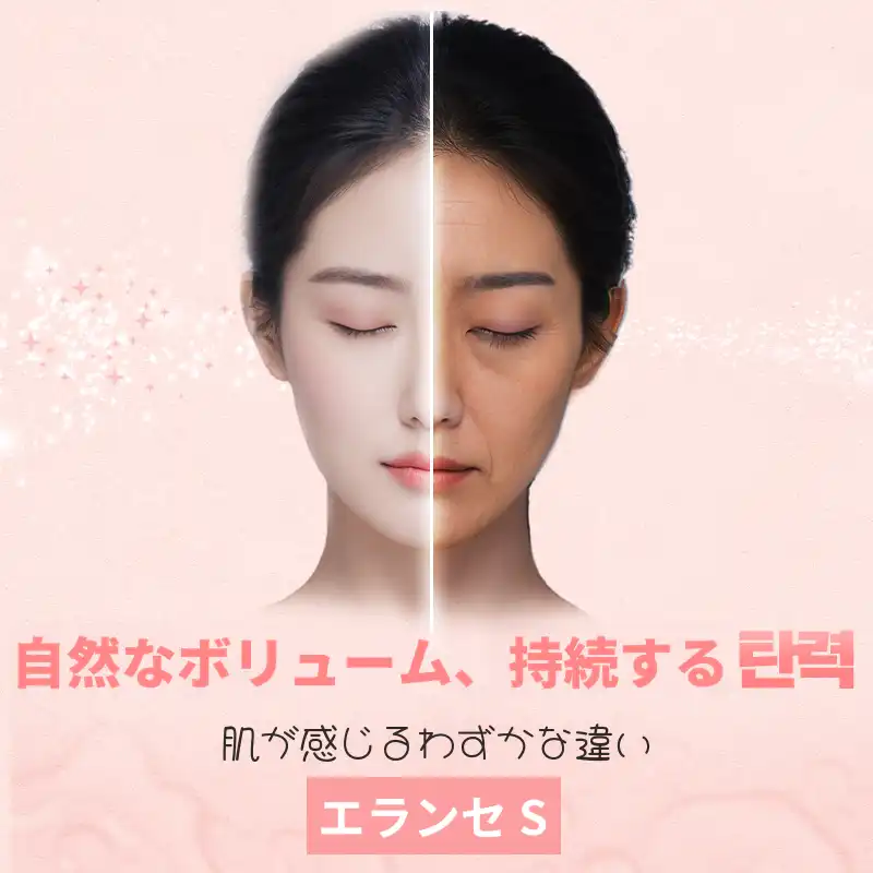 シャインユ_エランセS 3+1CC