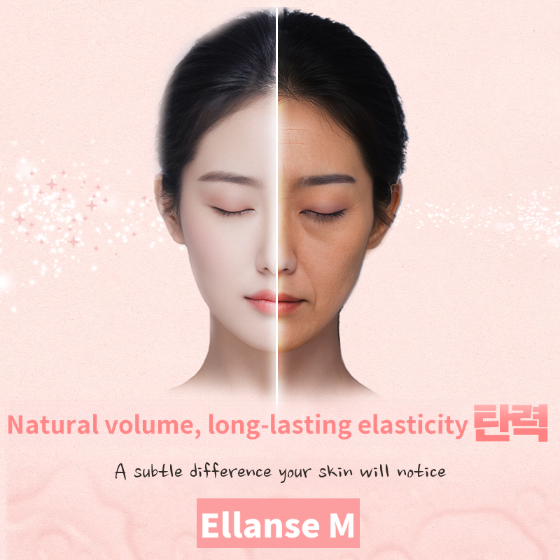 Shine You_Elance M 1CC