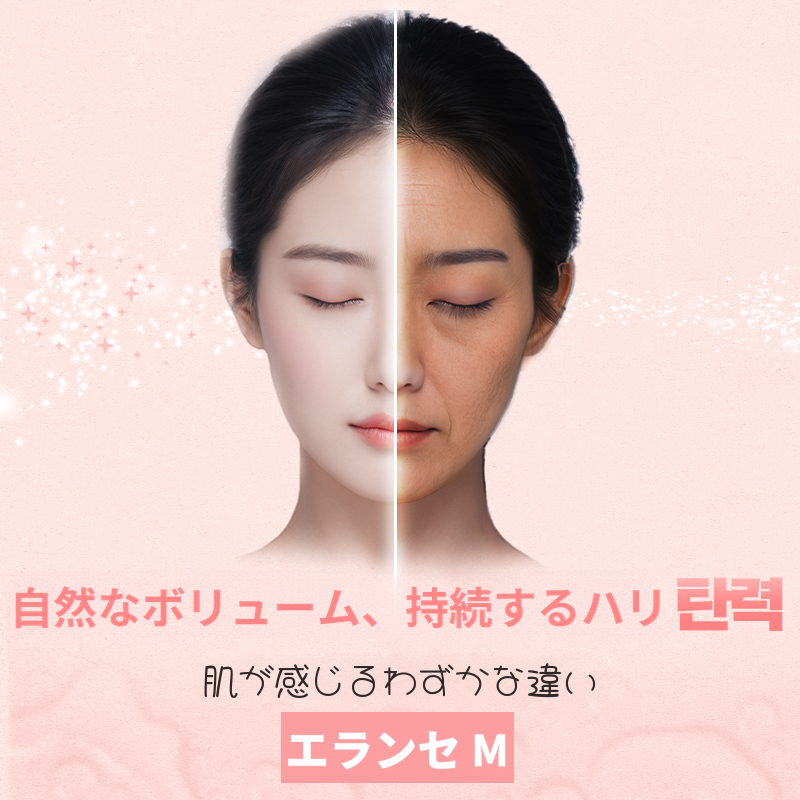 シャインユ_エランセM 1CC
