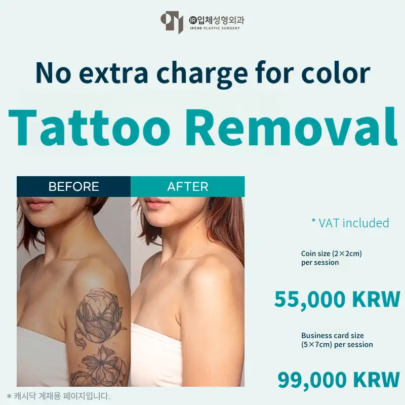 Tattoo Removal Without Additional Fees