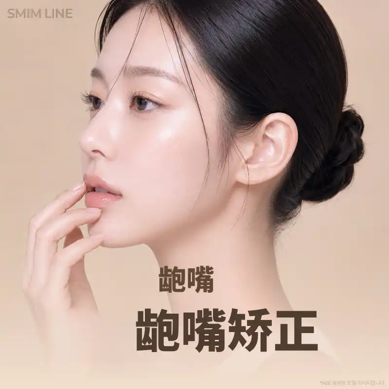 非手术无照片展示的龅牙矫正