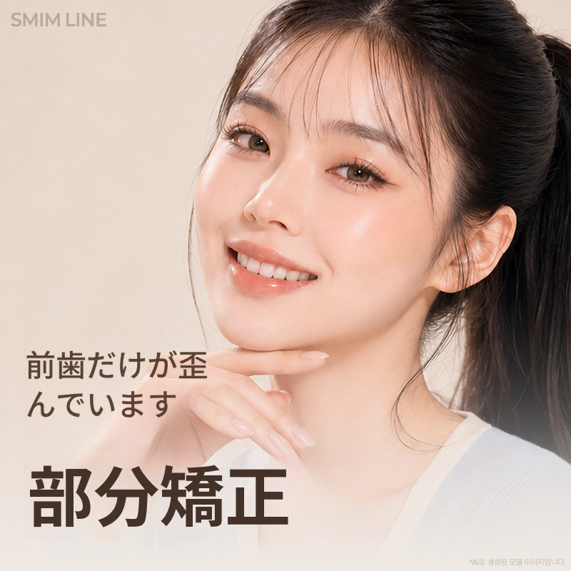 ミニフィット迅速矯正 頑固な速さ 前歯矯正