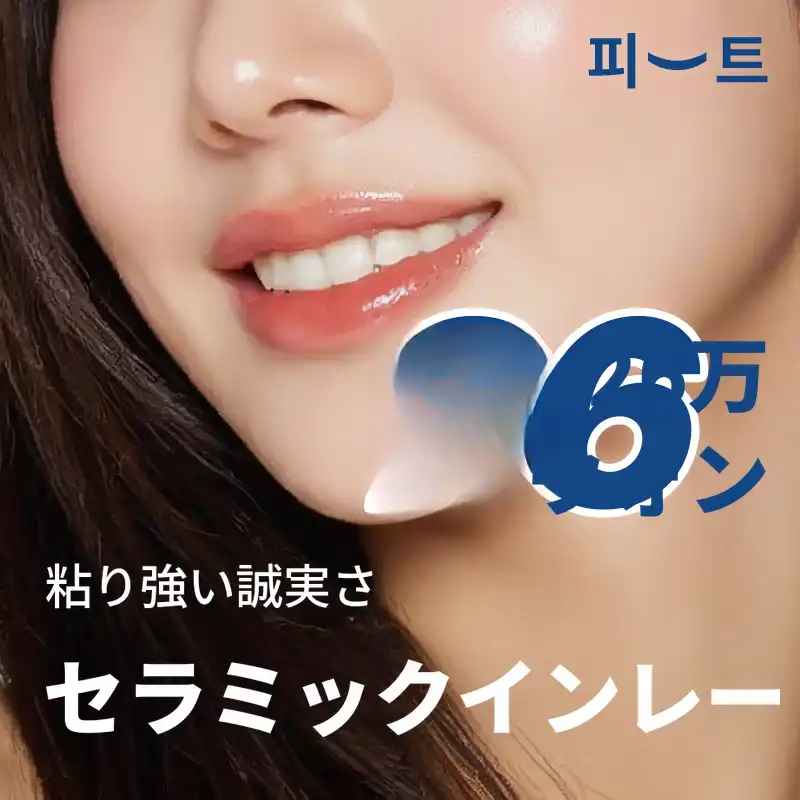 虫歯治療インレー 細心の正直