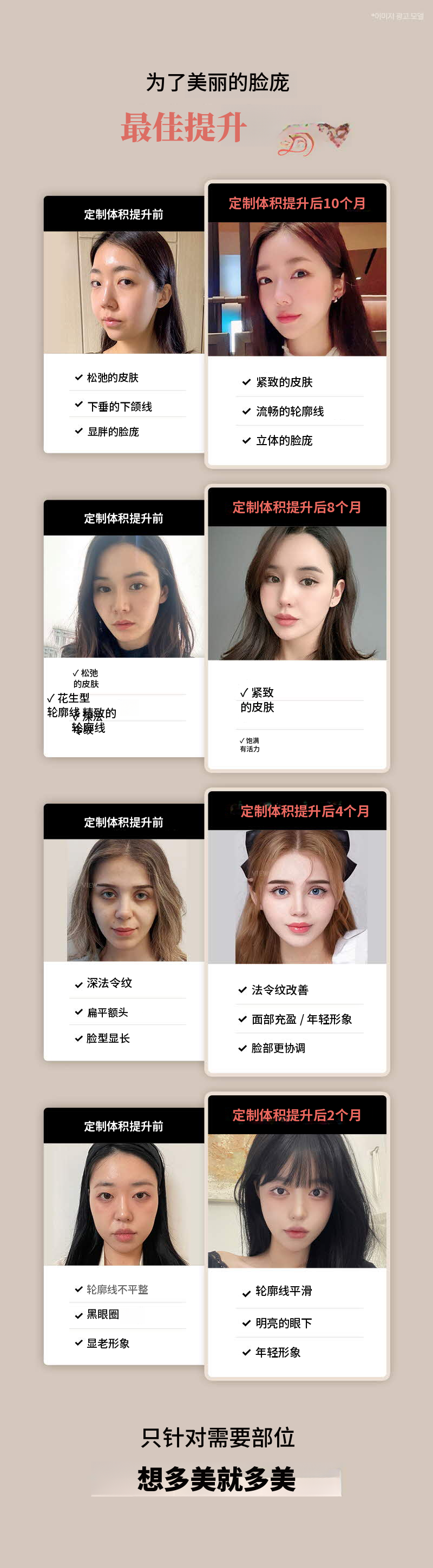 ❤美容❤定制立体提升