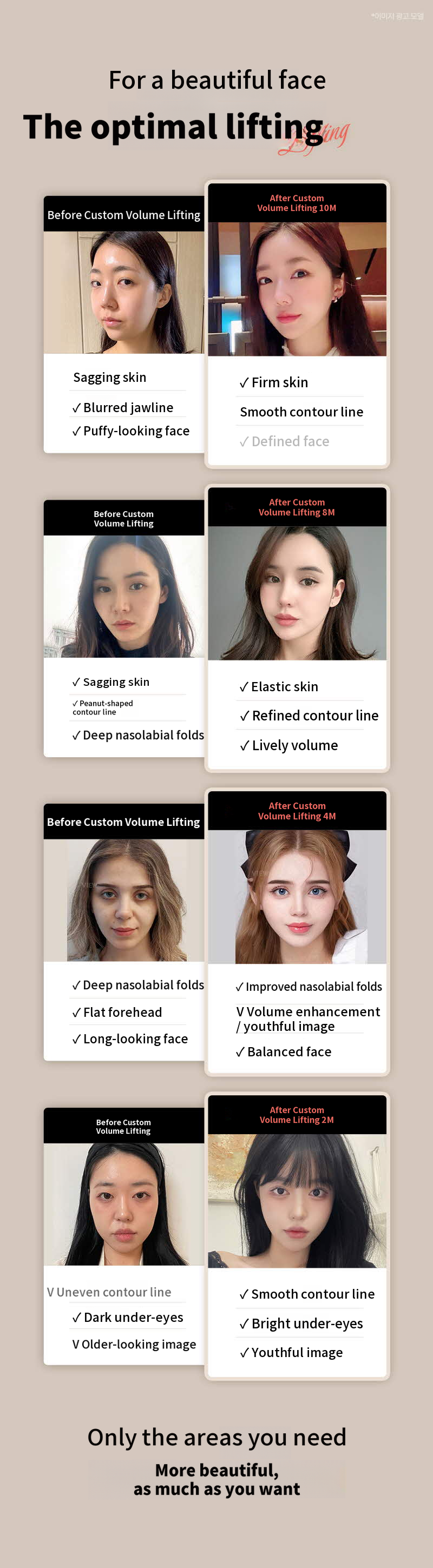 ❤View❤Custom Volume Lifting