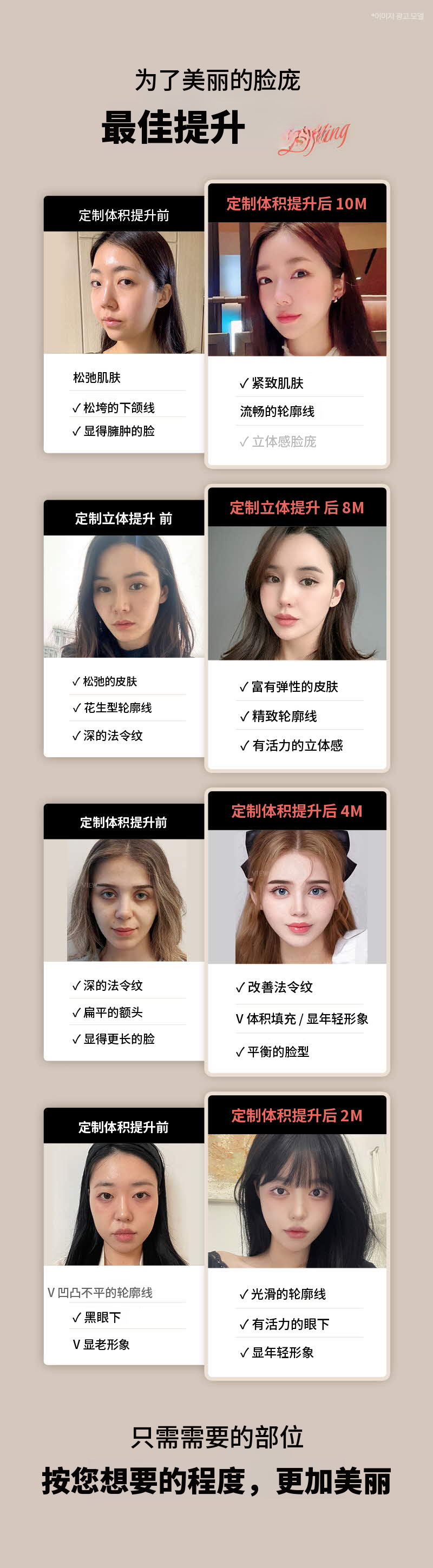 ❤视图❤自定义容积提升