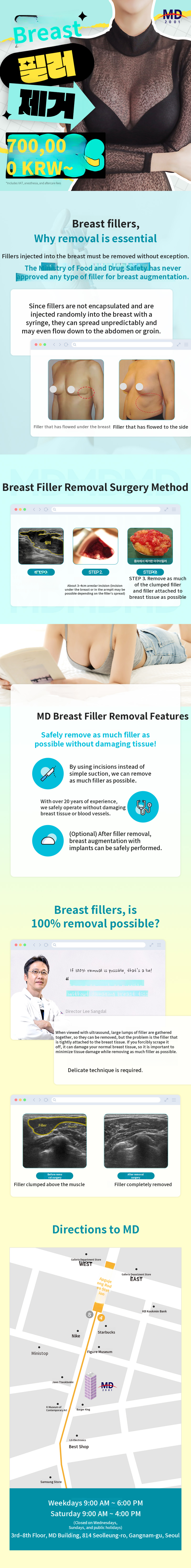💙MD Breast Filler Removal❤