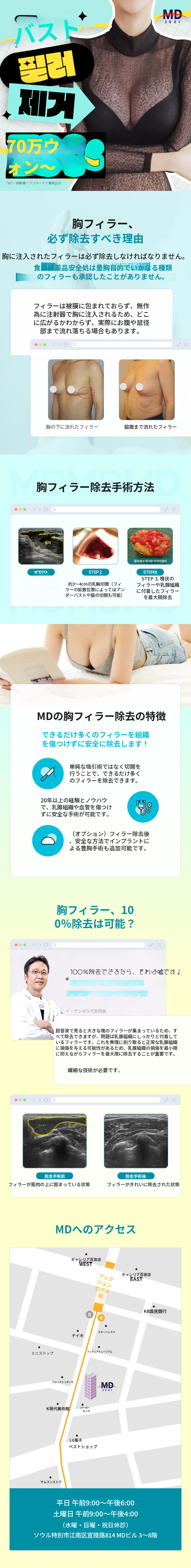 💙MD胸フィラー除去❤