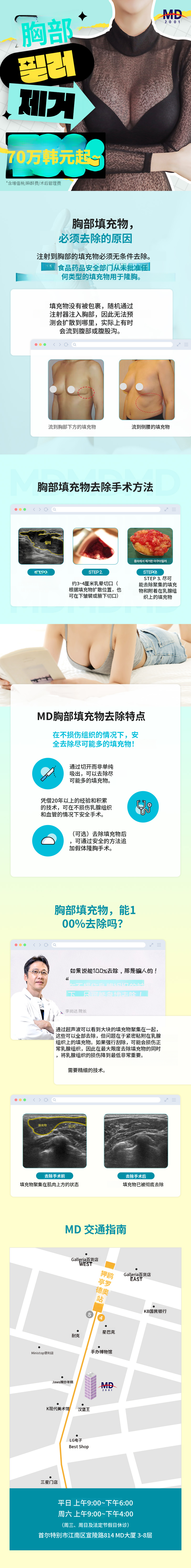 💙MD胸部填充物去除❤