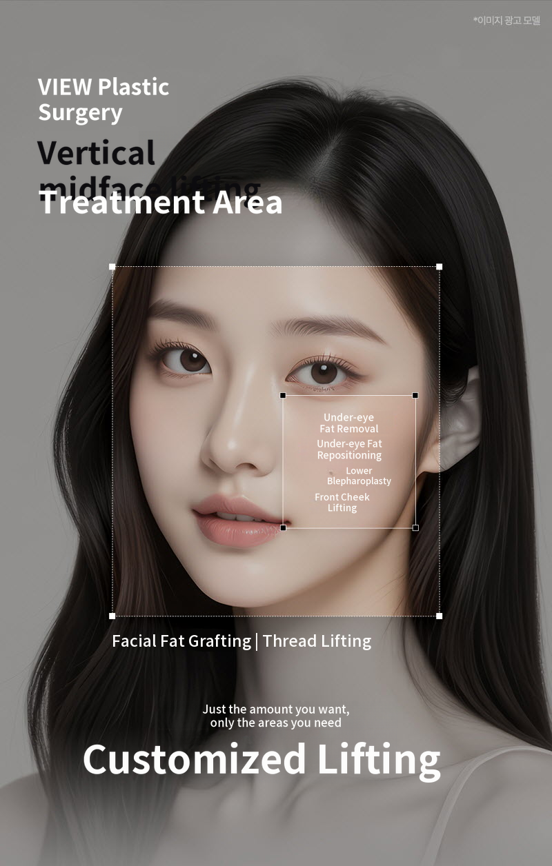 ❤View❤ Vertical Midface Lifting