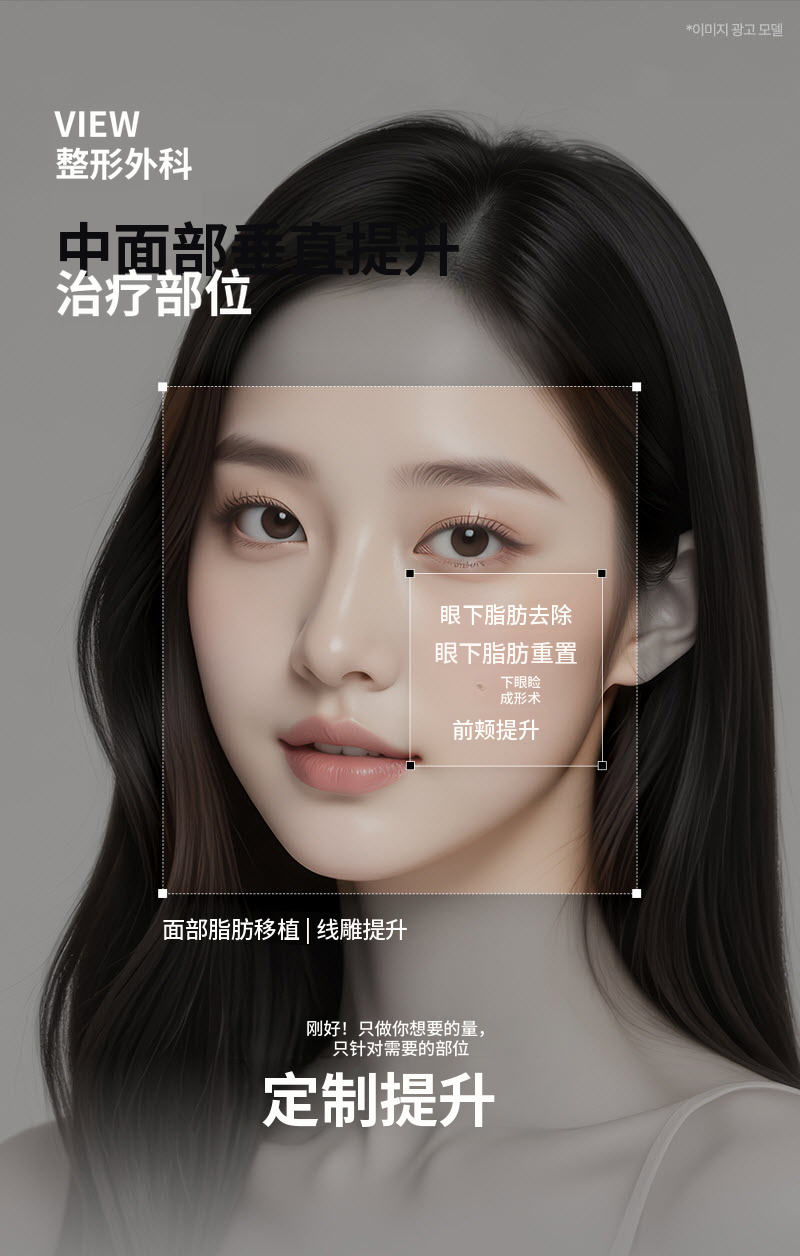 ❤视线❤中面垂直提升