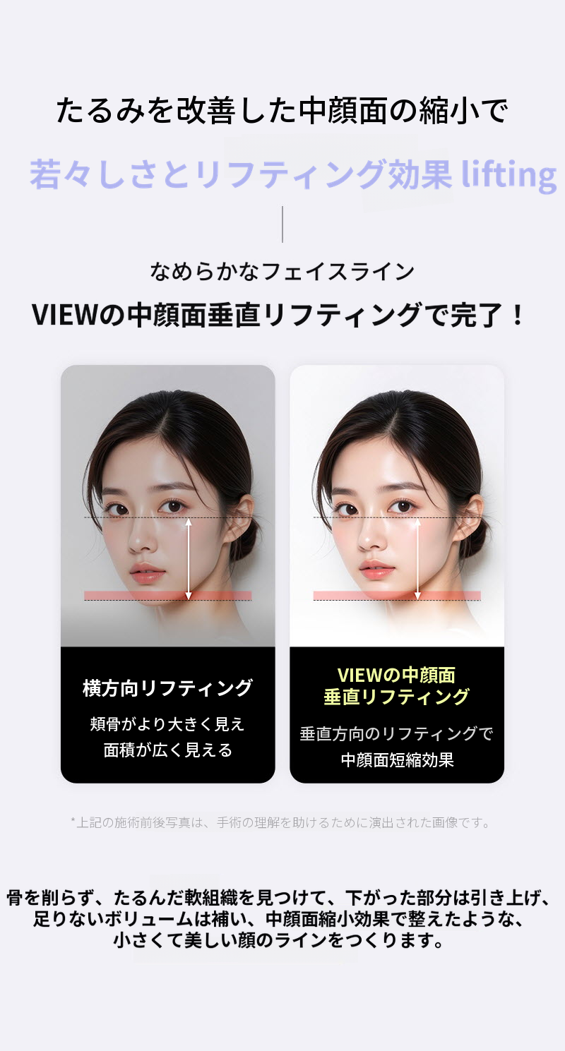 ❤ビュ❤中顔面垂直リフティング