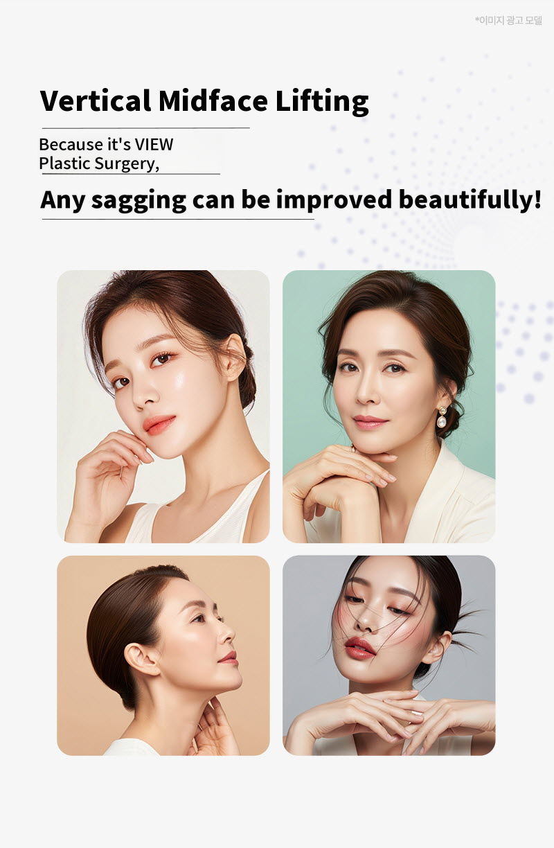 ❤View❤ Vertical Midface Lifting