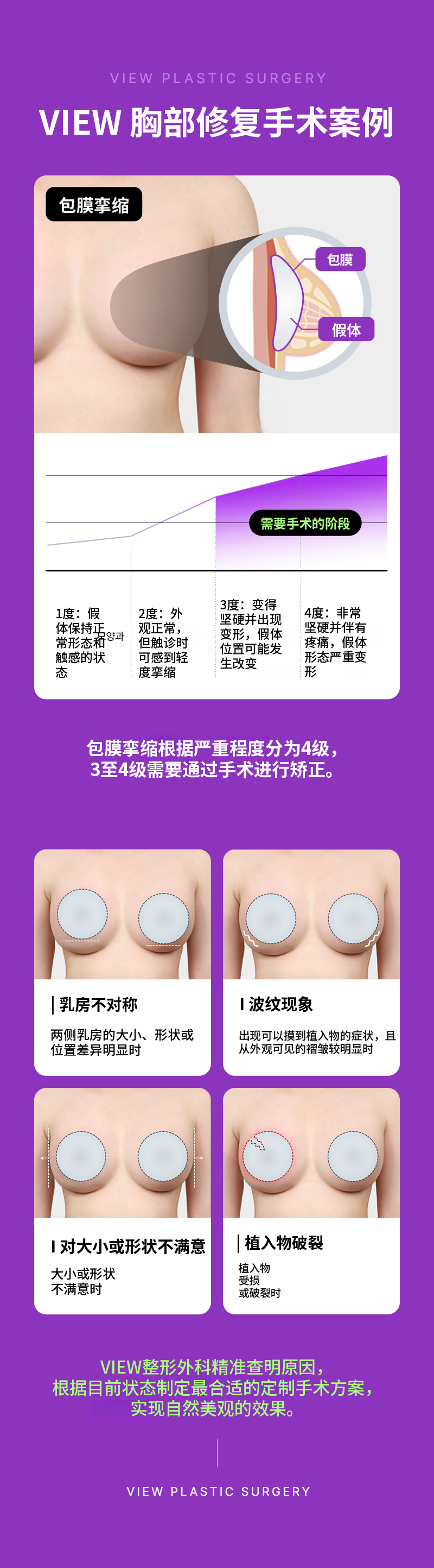 ❤维尤❤胸部修复手术