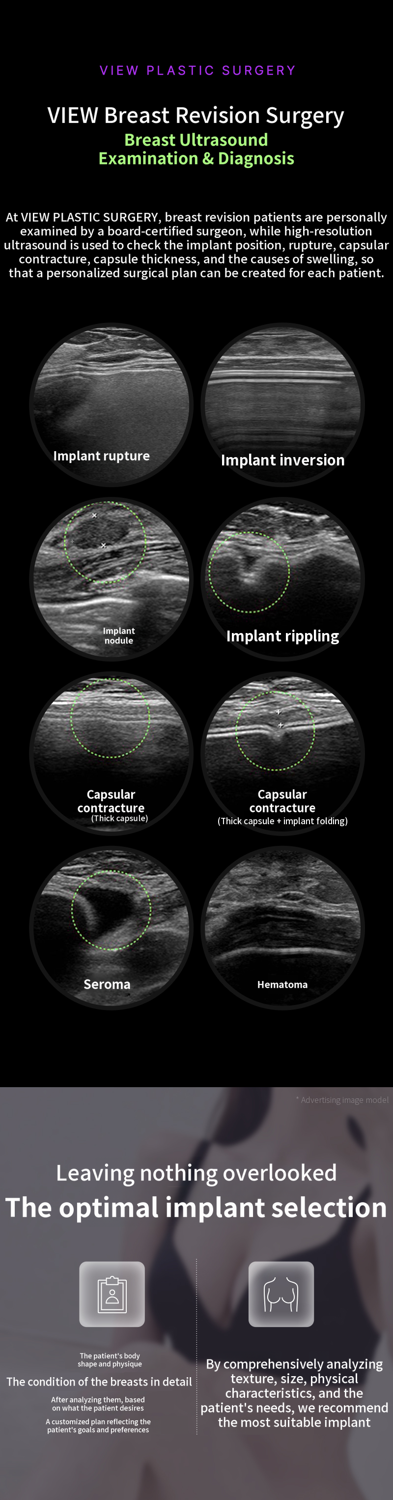 ❤View❤ Breast Revision Surgery