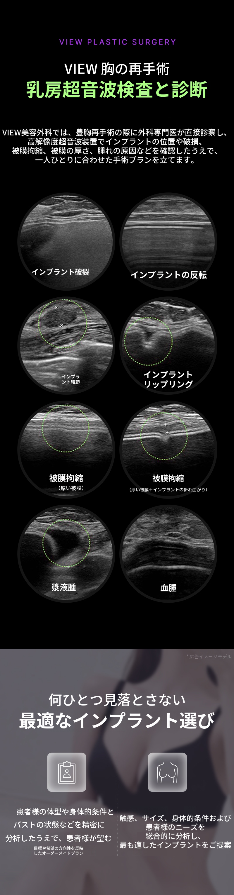 ❤ビュー❤豊胸再手術