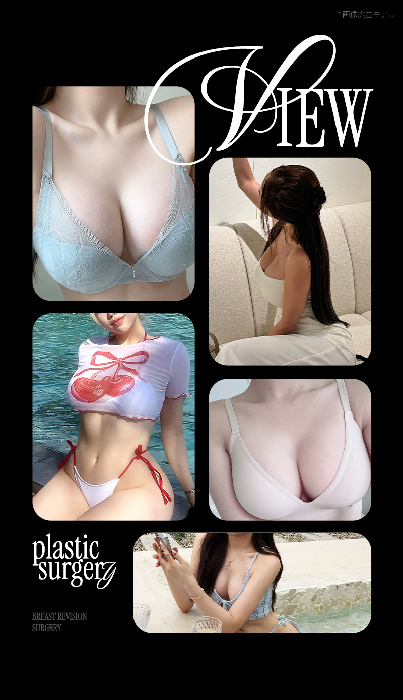 ❤ビュー❤豊胸再手術