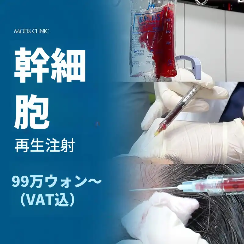 青潭モズ幹細胞注射