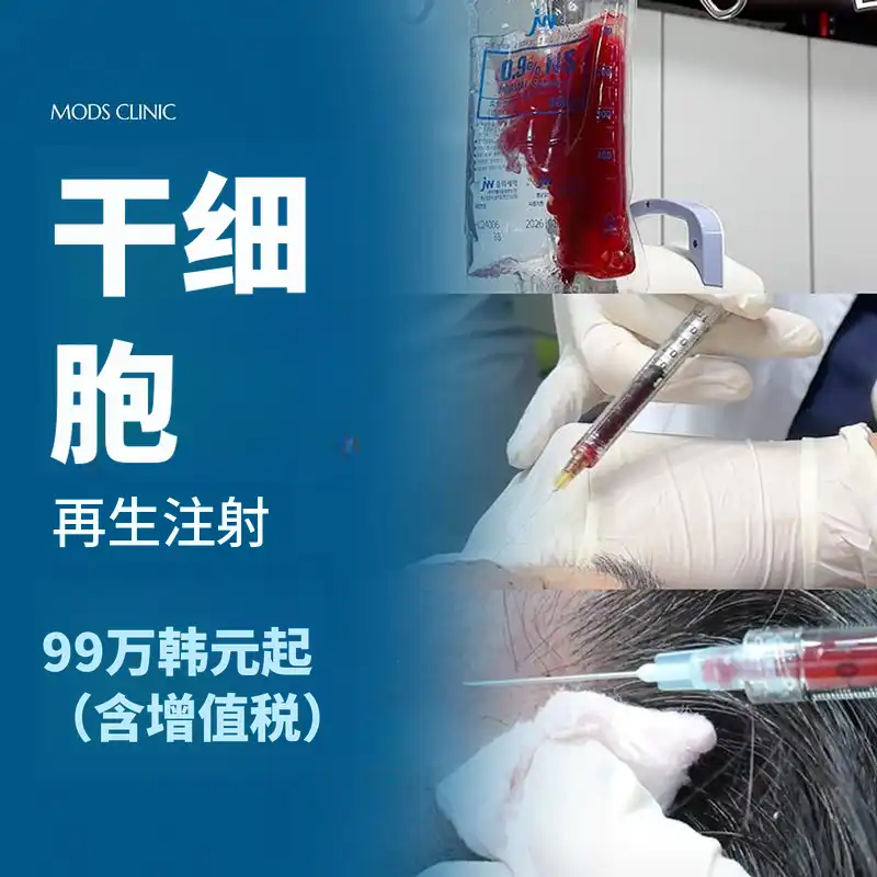 清潭MOZ干细胞注射