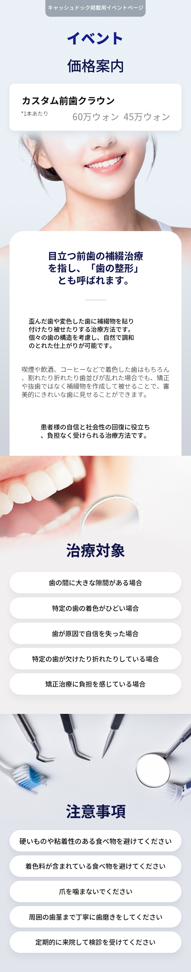 カスタム前歯クラウン